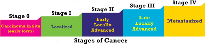 Stages of Cancer